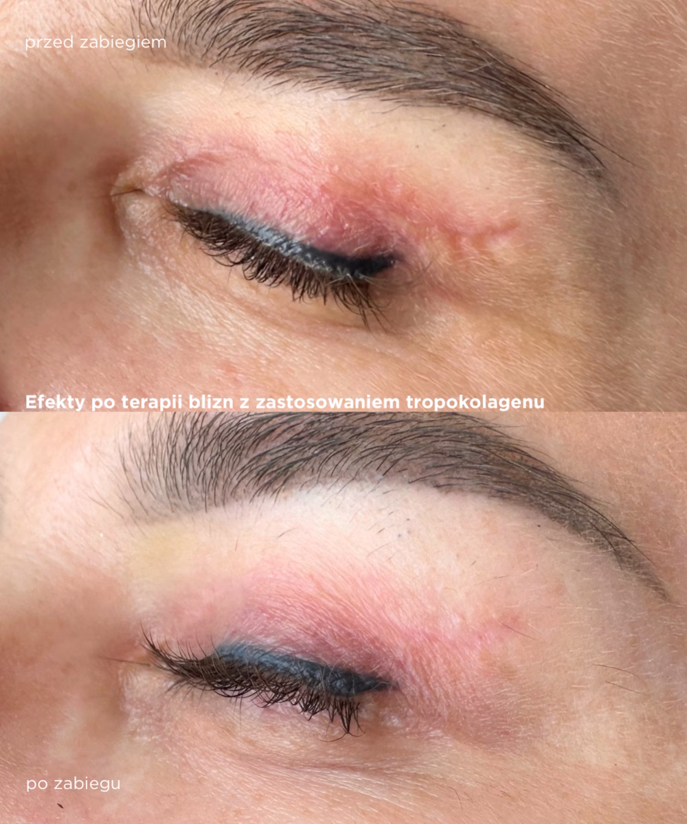 Tomaszewska_Clinic_efekty_zabiegow_-01