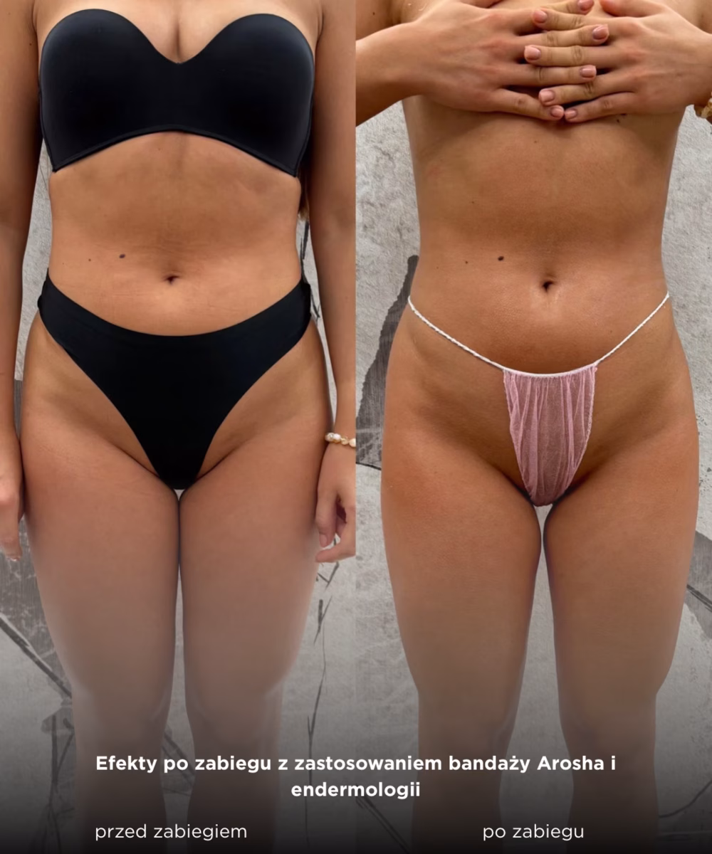 Tomaszewska_Clinic_efekty_zabiegow_-14