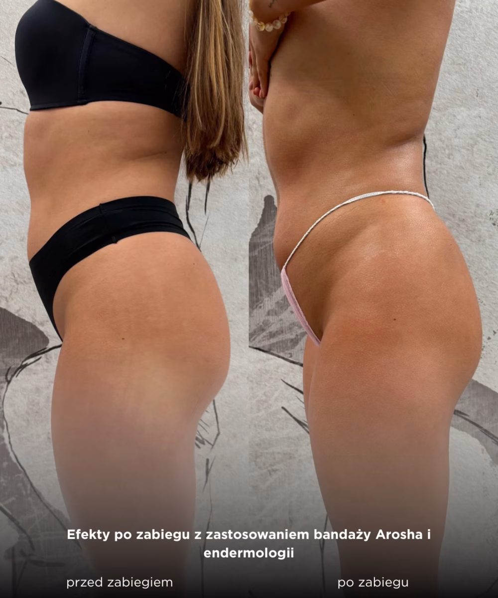 Tomaszewska_Clinic_efekty_zabiegow_-15