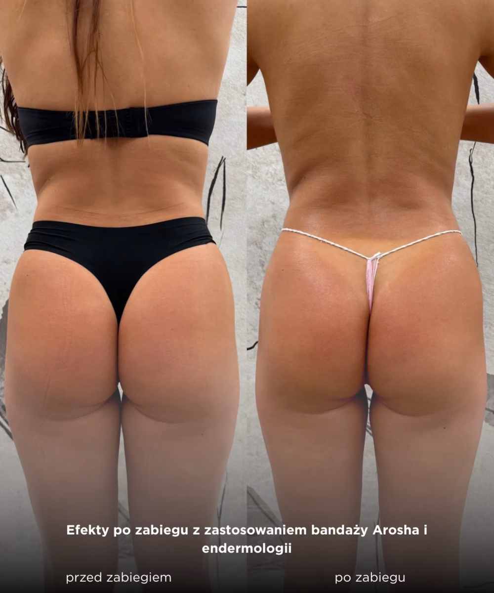Tomaszewska_Clinic_efekty_zabiegow_-25