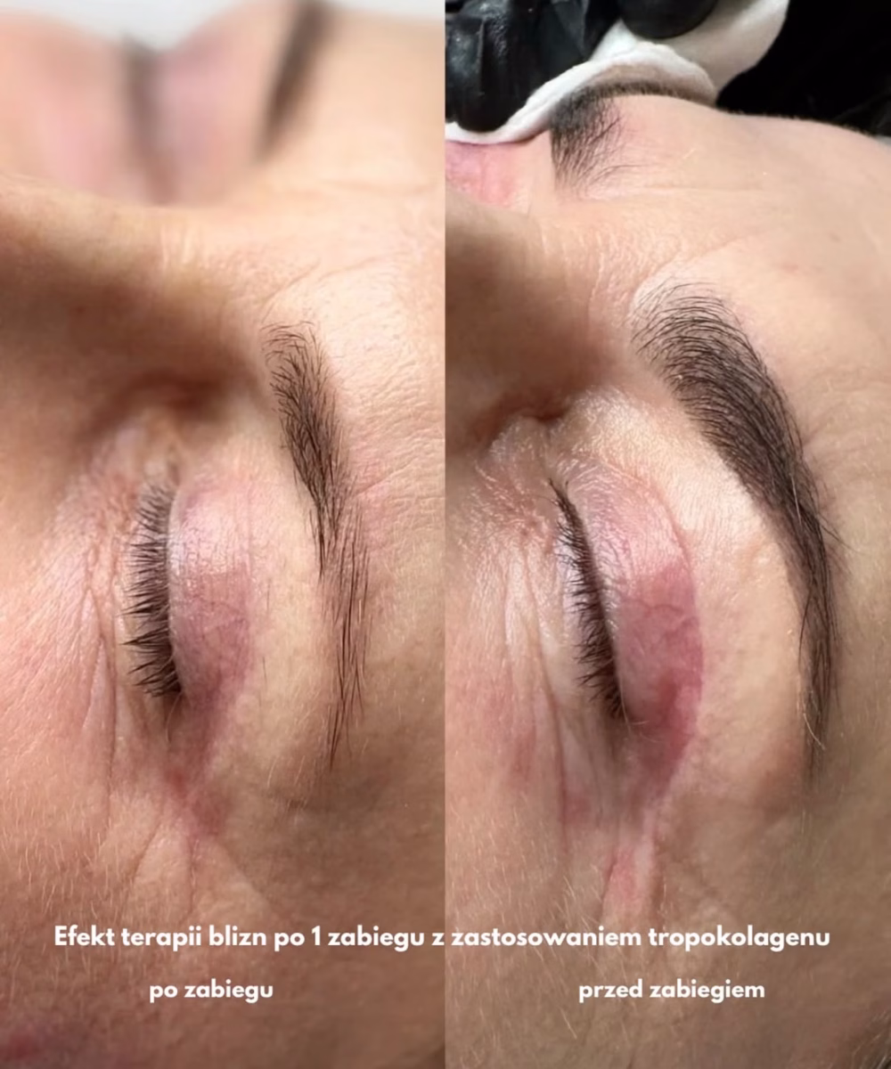 Tomaszewska_Clinic_efekty_zabiegow_-40