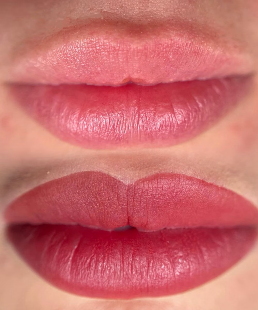 Tomaszewska_Clinic_efekty_zabiegow_-43